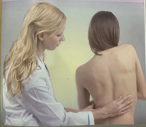 脊柱側彎早發(fā)現(xiàn)，早治療