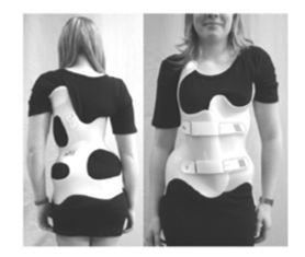 脊柱側(cè)彎支具